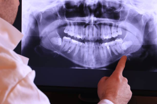 Best Same-Day Emergency Dentist in Fallston, MD