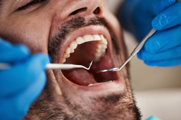 Best Emergency Dental Care for Trauma or Injury in Fallston, MD